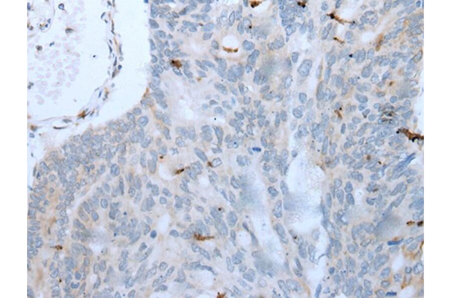 GKN1 Antibody from Signalway Antibody (43725) - Antibodies.com