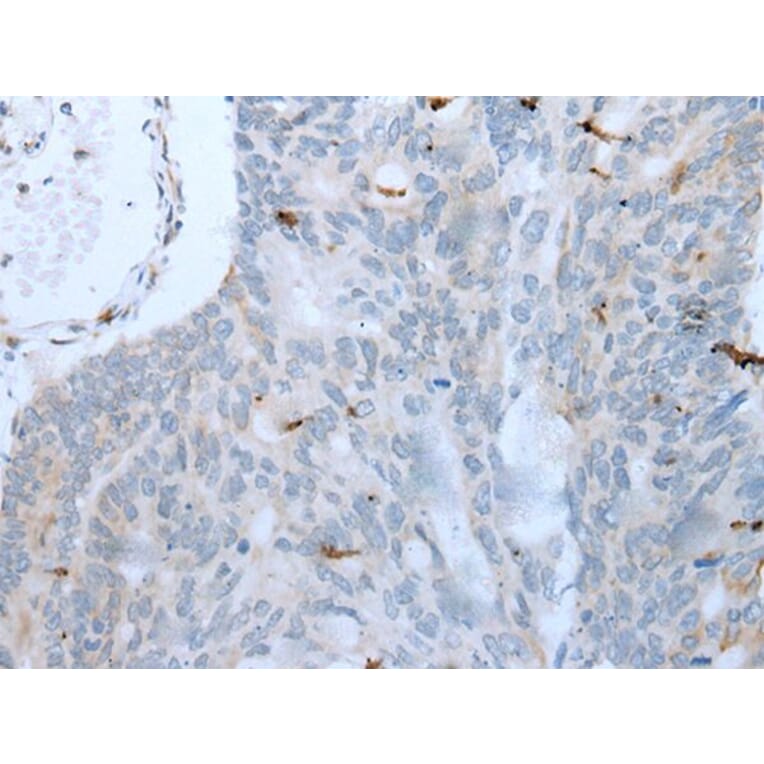 GKN1 Antibody from Signalway Antibody (43725) - Antibodies.com