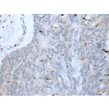 GKN1 Antibody from Signalway Antibody (43725) - Antibodies.com