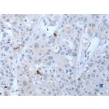 GKN1 Antibody from Signalway Antibody (43725) - Antibodies.com