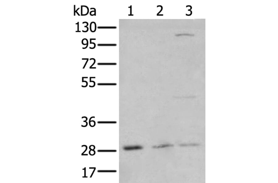 KLF6 Antibody from Signalway Antibody (43742) - Antibodies.com