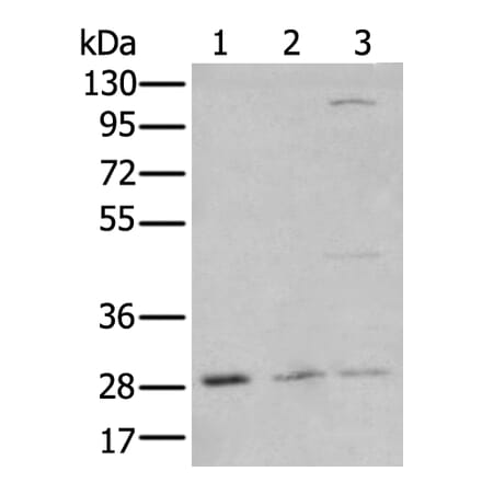 KLF6 Antibody from Signalway Antibody (43742) - Antibodies.com