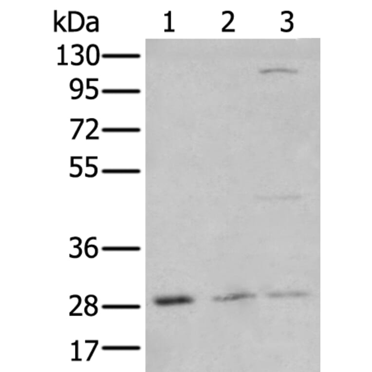 KLF6 Antibody from Signalway Antibody (43742) - Antibodies.com