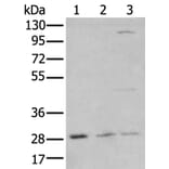 KLF6 Antibody from Signalway Antibody (43742) - Antibodies.com