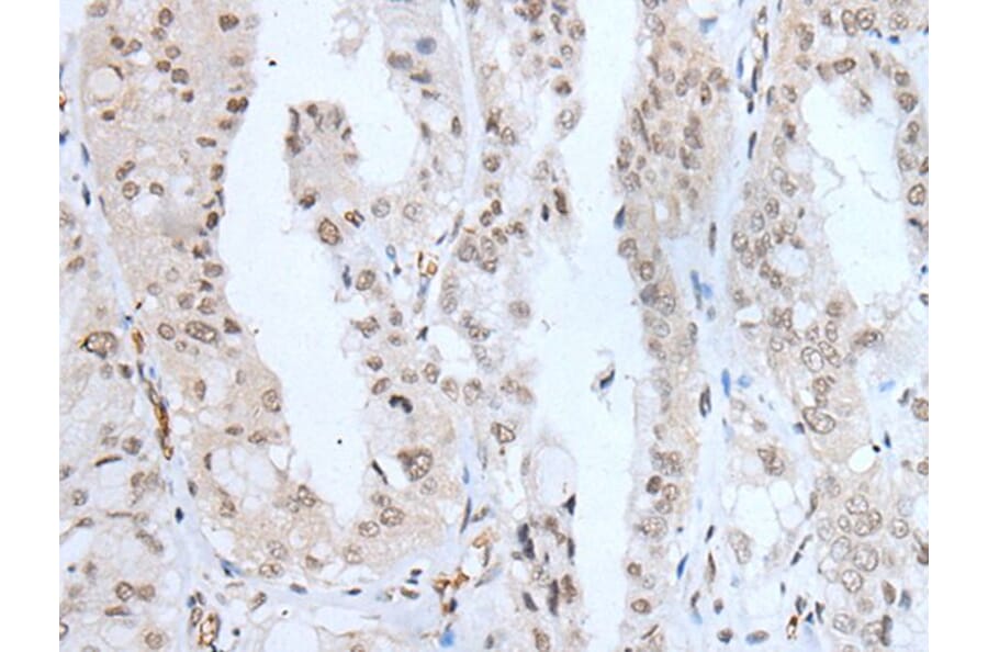 KLF6 Antibody from Signalway Antibody (43742) - Antibodies.com