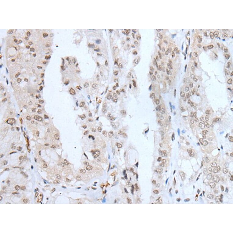 KLF6 Antibody from Signalway Antibody (43742) - Antibodies.com
