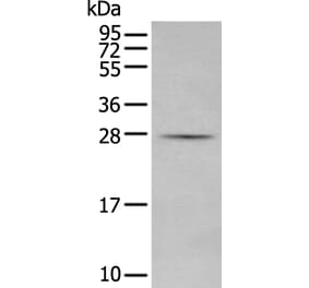 MBL2 Antibody from Signalway Antibody (43743) - Antibodies.com