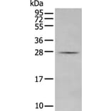 MBL2 Antibody from Signalway Antibody (43743) - Antibodies.com