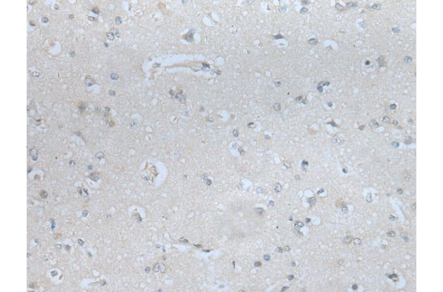 MBL2 Antibody from Signalway Antibody (43743) - Antibodies.com