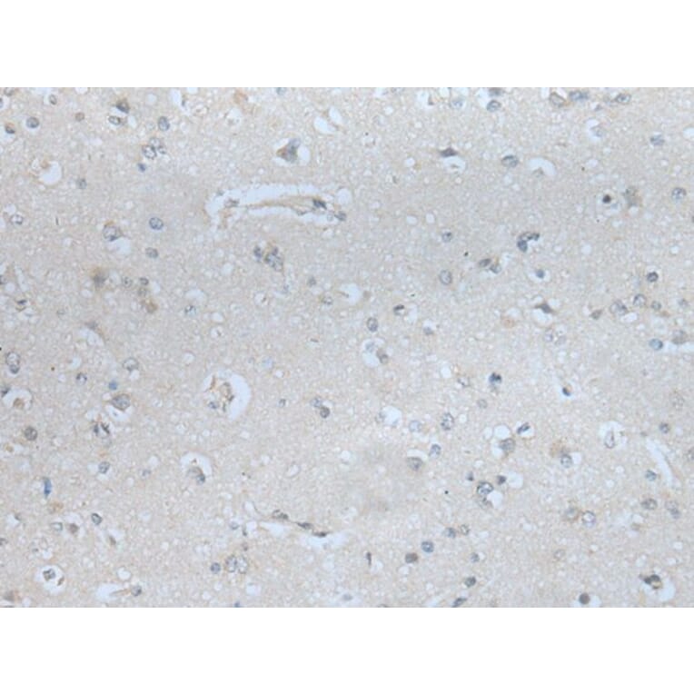 MBL2 Antibody from Signalway Antibody (43743) - Antibodies.com