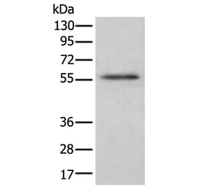 CSF1 Antibody from Signalway Antibody (43751) - Antibodies.com