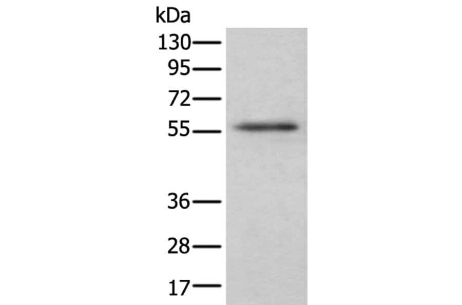 CSF1 Antibody from Signalway Antibody (43751) - Antibodies.com