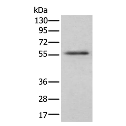 CSF1 Antibody from Signalway Antibody (43751) - Antibodies.com