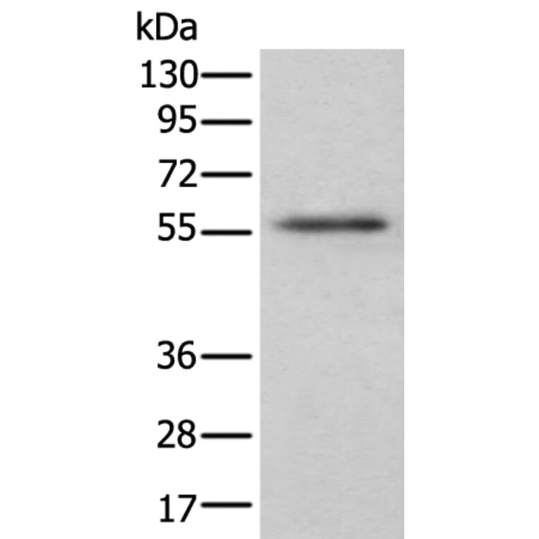 CSF1 Antibody from Signalway Antibody (43751) - Antibodies.com