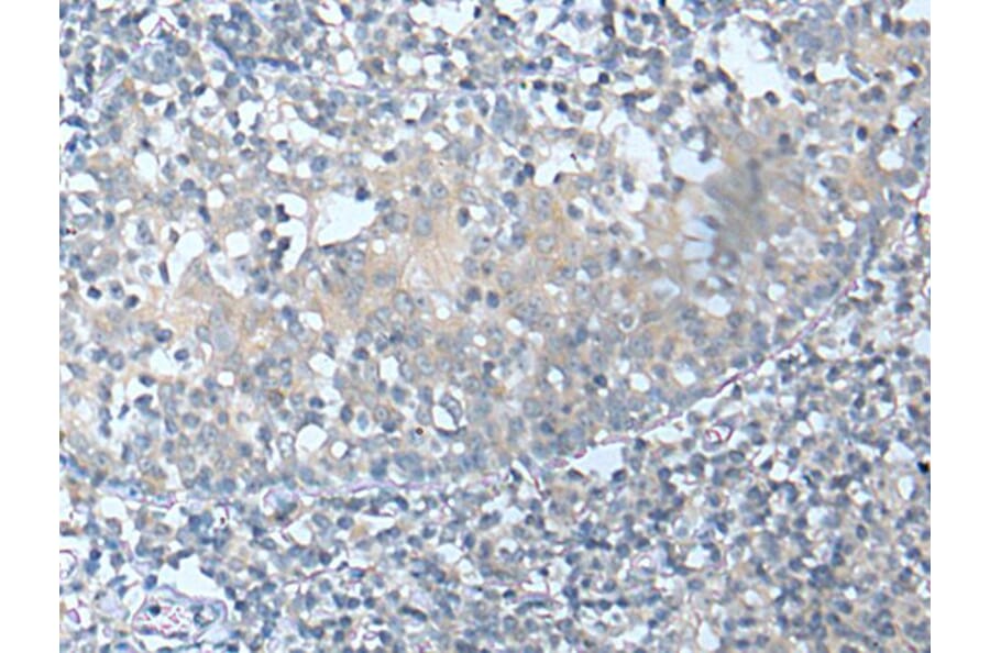 CSF1 Antibody from Signalway Antibody (43751) - Antibodies.com