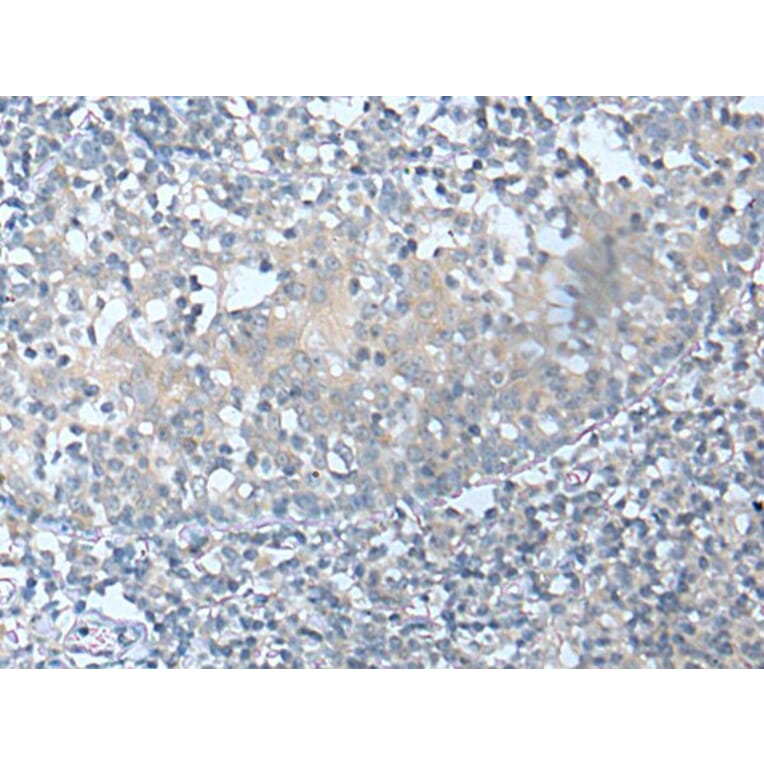 CSF1 Antibody from Signalway Antibody (43751) - Antibodies.com