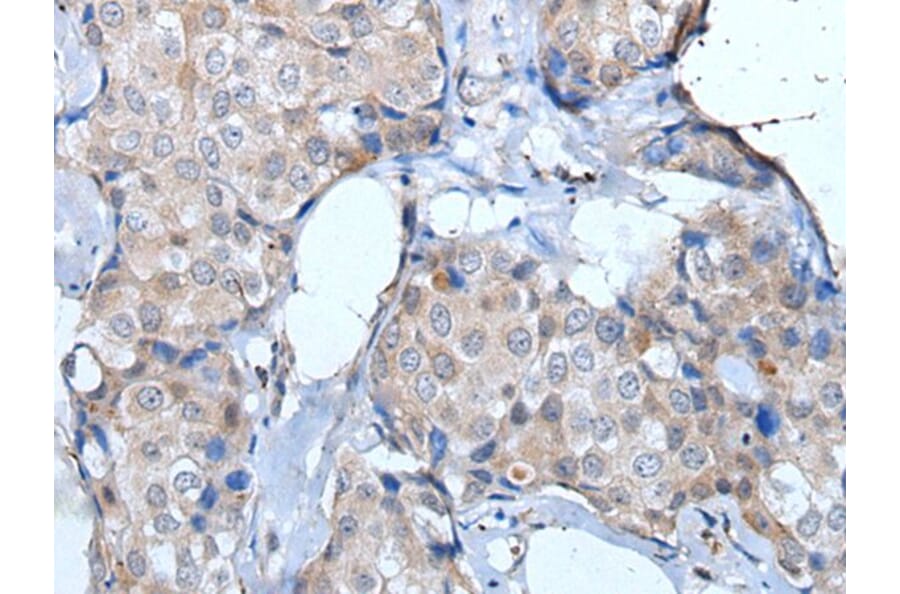 ULK1 Antibody from Signalway Antibody (43772) - Antibodies.com