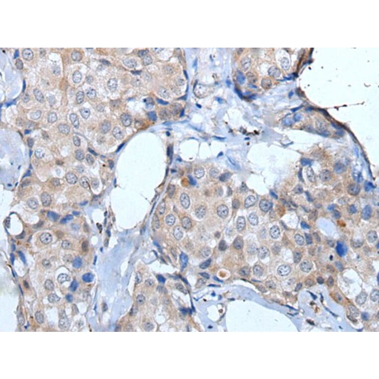 ULK1 Antibody from Signalway Antibody (43772) - Antibodies.com