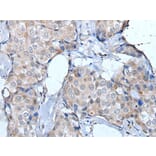 ULK1 Antibody from Signalway Antibody (43772) - Antibodies.com