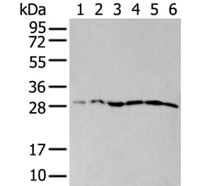 ETFB Antibody from Signalway Antibody (43776) - Antibodies.com