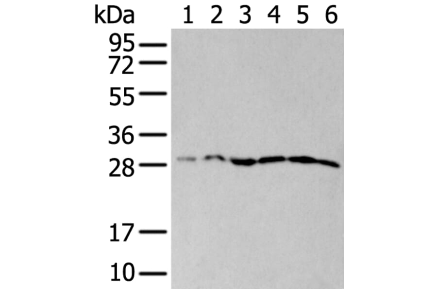 ETFB Antibody from Signalway Antibody (43776) - Antibodies.com