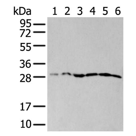 ETFB Antibody from Signalway Antibody (43776) - Antibodies.com