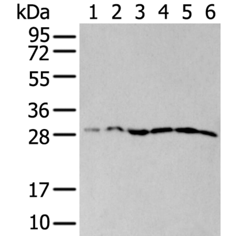 ETFB Antibody from Signalway Antibody (43776) - Antibodies.com