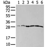 ETFB Antibody from Signalway Antibody (43776) - Antibodies.com