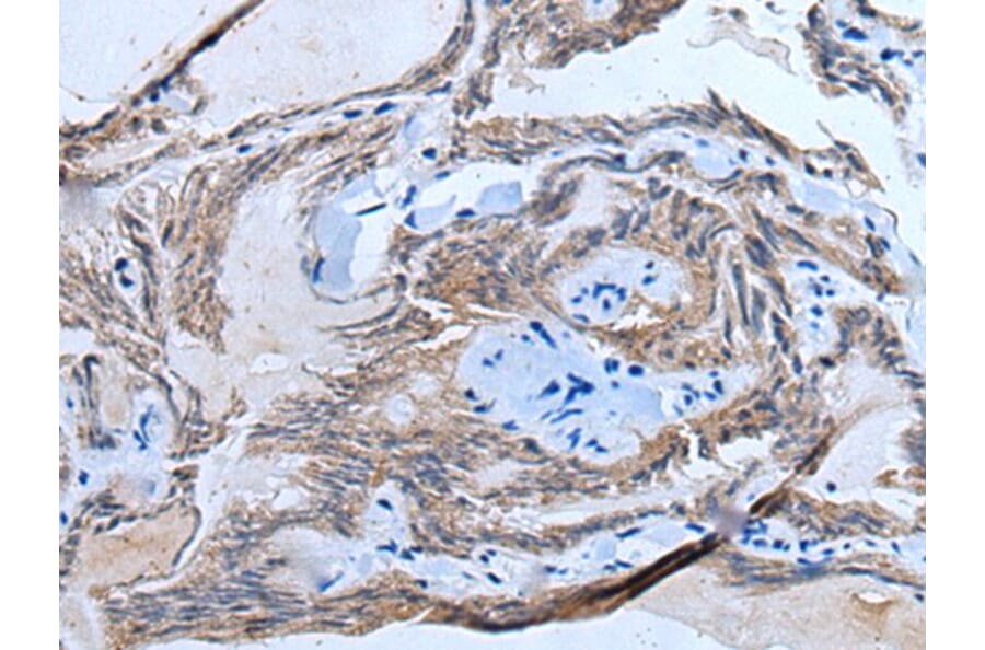 ETFB Antibody from Signalway Antibody (43776) - Antibodies.com