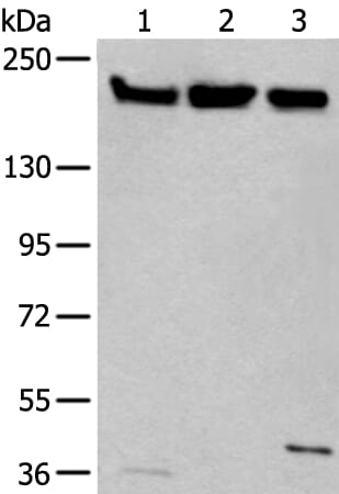 Gel: 6%SDS-PAGE Lysate: 40 &#956;g, Lane 1-3: Hela£¬231 and K562 cell lysates, Primary antibody: XRN1 antibody at dilution 1/250, Secondary antibody: Goat anti rabbit IgG at 1/8000 dilution, Exposure time: 2 minutes