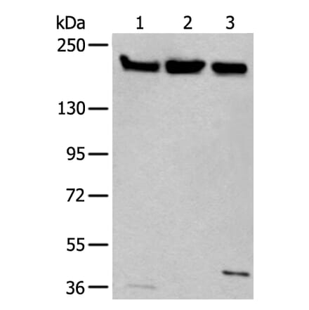 XRN1 Antibody from Signalway Antibody (43803) - Antibodies.com