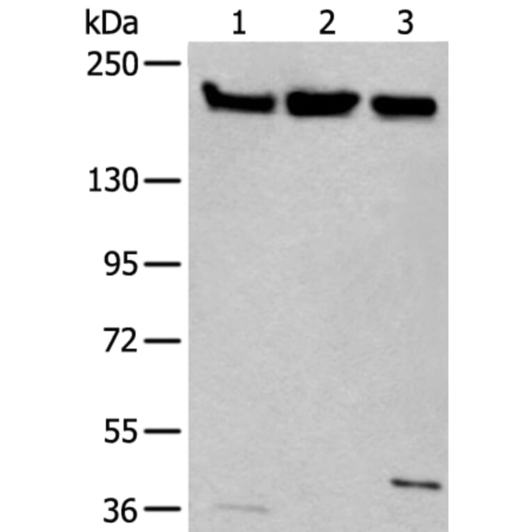 XRN1 Antibody from Signalway Antibody (43803) - Antibodies.com