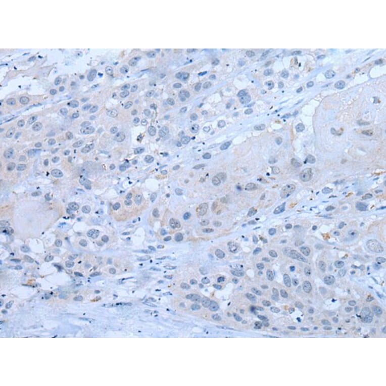 XRN1 Antibody from Signalway Antibody (43803) - Antibodies.com