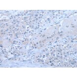 XRN1 Antibody from Signalway Antibody (43803) - Antibodies.com
