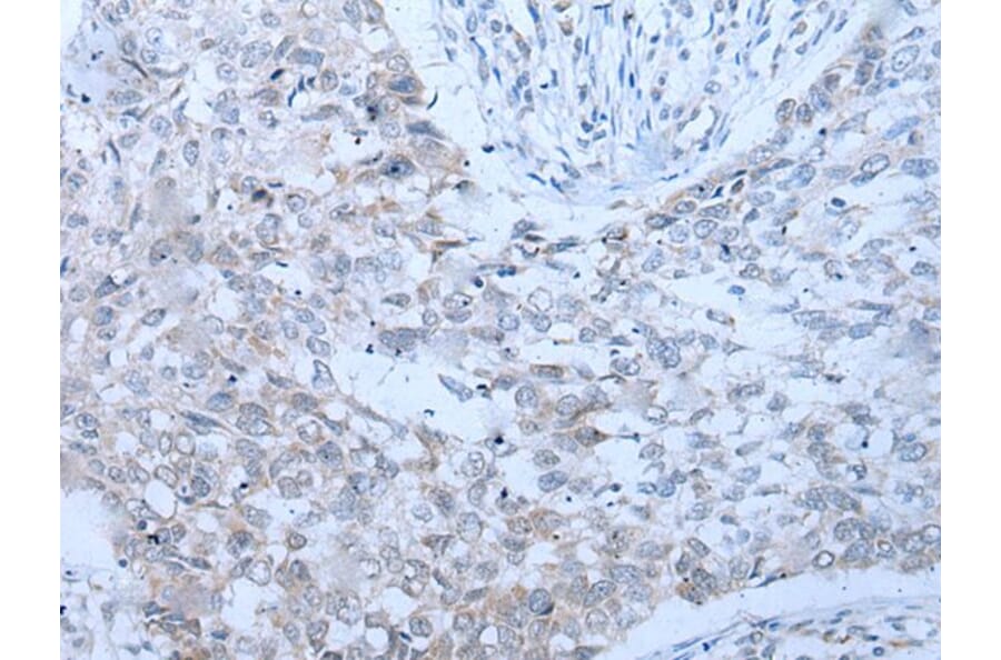 XRN1 Antibody from Signalway Antibody (43803) - Antibodies.com