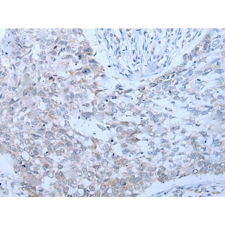 XRN1 Antibody from Signalway Antibody (43803) - Antibodies.com