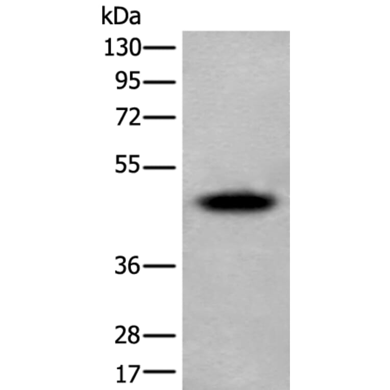 SUN5 Antibody from Signalway Antibody (43813) - Antibodies.com