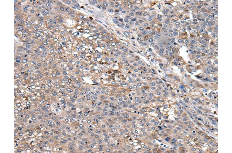 SUN5 Antibody from Signalway Antibody (43813) - Antibodies.com