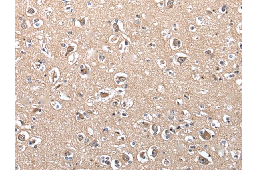 SUN5 Antibody from Signalway Antibody (43813) - Antibodies.com