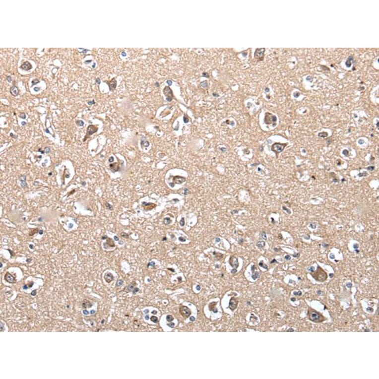 SUN5 Antibody from Signalway Antibody (43813) - Antibodies.com