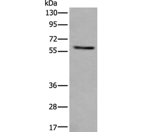 VRK2 Antibody from Signalway Antibody (43825) - Antibodies.com