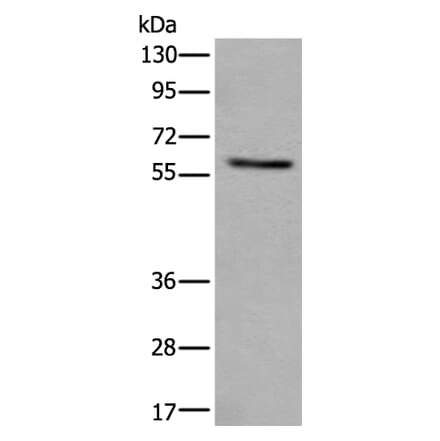 VRK2 Antibody from Signalway Antibody (43825) - Antibodies.com