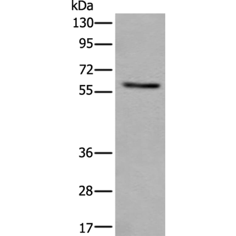 VRK2 Antibody from Signalway Antibody (43825) - Antibodies.com