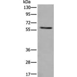 VRK2 Antibody from Signalway Antibody (43825) - Antibodies.com
