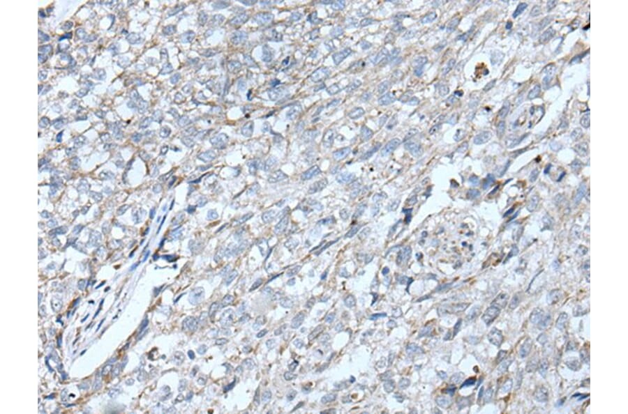 VRK2 Antibody from Signalway Antibody (43825) - Antibodies.com