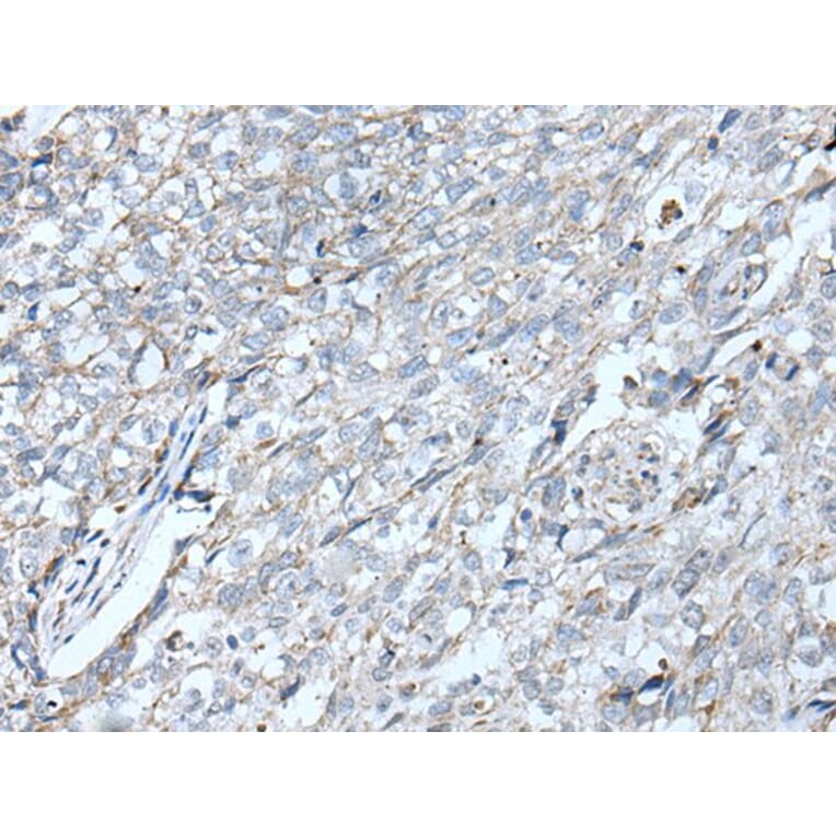 VRK2 Antibody from Signalway Antibody (43825) - Antibodies.com