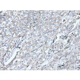 VRK2 Antibody from Signalway Antibody (43825) - Antibodies.com