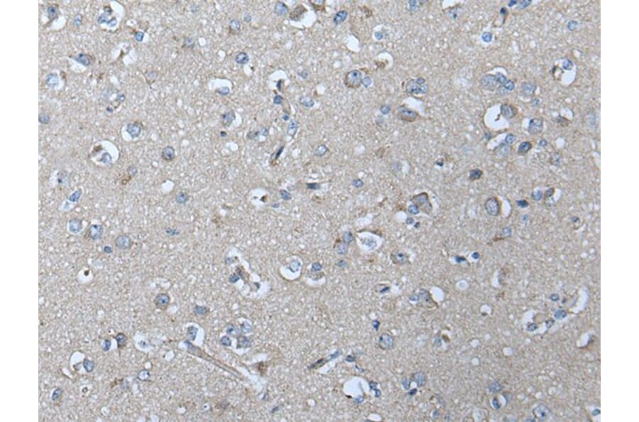 VRK2 Antibody from Signalway Antibody (43825) - Antibodies.com