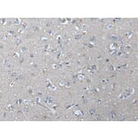 VRK2 Antibody from Signalway Antibody (43825) - Antibodies.com