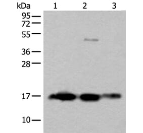 SNCB Antibody from Signalway Antibody (43845) - Antibodies.com